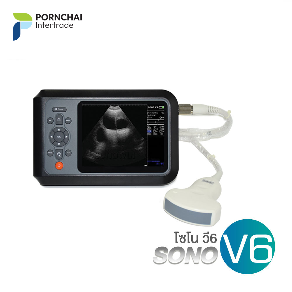 เครื่องอัลตราซาวด์ รุ่น Sono V6 แบบพกพา พร้อมโพรบ 3.5MHz Convex