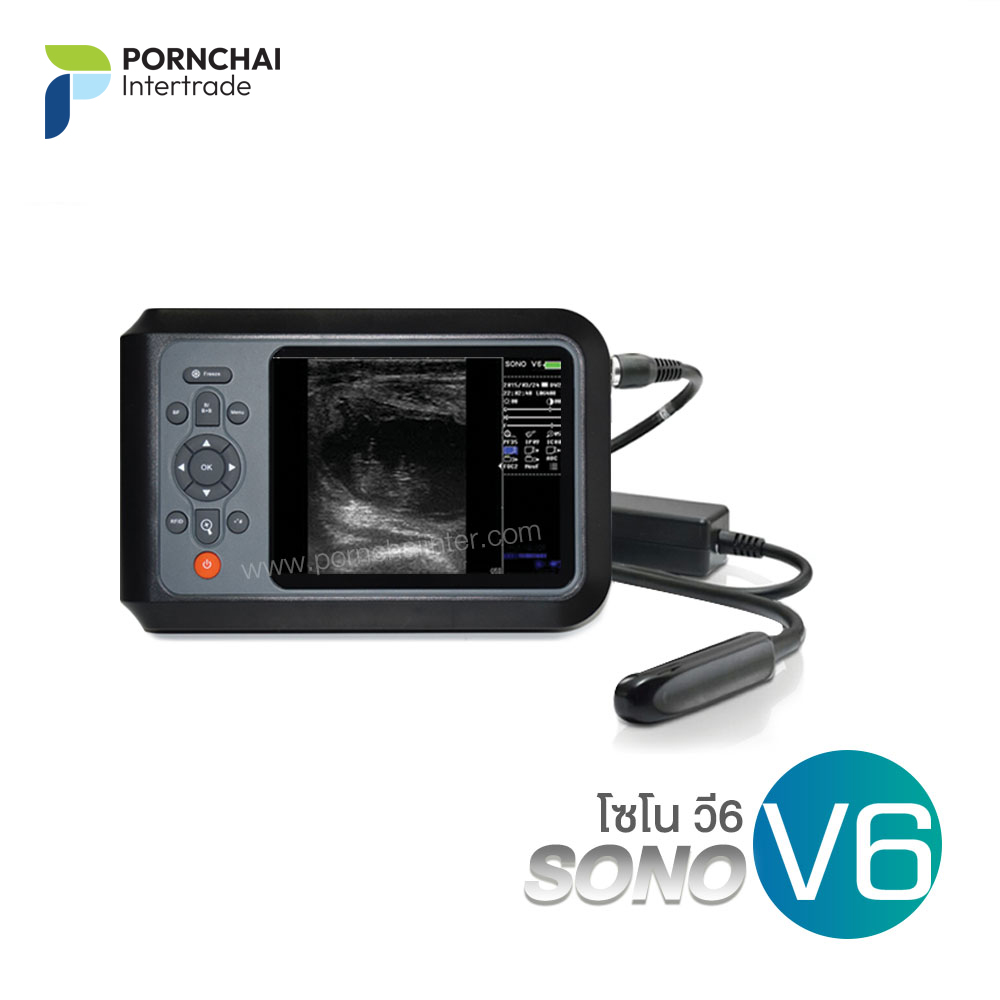 เครื่องอัลตราซาวด์ รุ่น Sono V6 แบบพกพา พร้อมโพรบ 6.5 MHz Rectal